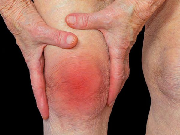 घुटने के दर्द के घरेलू नुस्खे - Joint pain relief